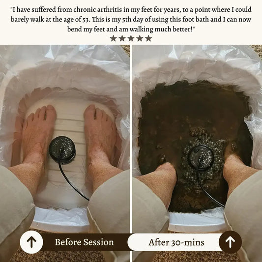 Heallifeco Ionic Foot Spa | Remove Toxins and Heavy Metals for a Healthier Life 🇳🇴